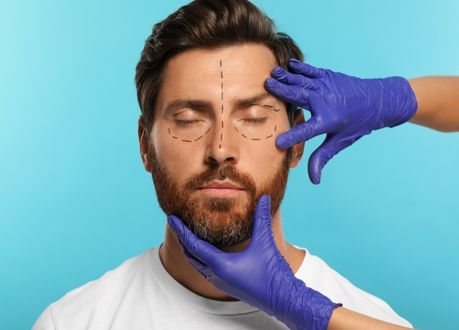 Blefaroplastia hombres