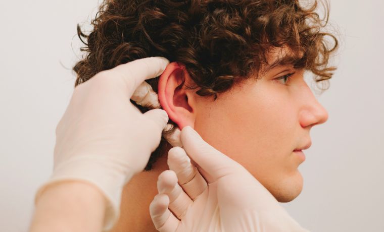 recuperación otoplastia